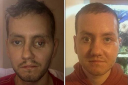 Première reconstruction du visage avec une imprimante 3D