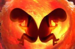 Un enfant de 4 ans retrouve un foetus dans son ventre