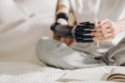 Manque d’afflux sanguin : il survit à la Covid-19 mais finit amputé de huit doigts