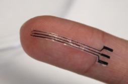 HTA résistante : un implant pas plus grand qu’un bout de doigt pour éviter les médicaments