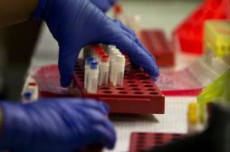 Herpès : de nouvelles pistes pour un vaccin et un test universel