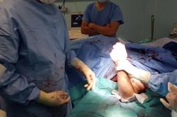 Réimplantation : la patiente devrait retrouver l’usage de ses bras