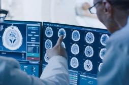 Cancer du cerveau de l’enfant : affamer les cellules pour soigner la maladie