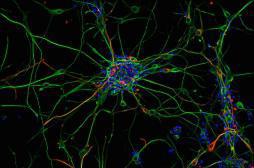 Epilepsies : vers la sortie de crises ?