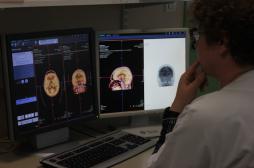 Mort subite : la grande inconnue des épilepsies 