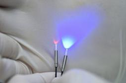 Thérapie photodynamique : quand la lumière détruit les tumeurs 