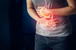 Léna Situations hospitalisée pour un ulcère gastrique : comment se manifeste cette maladie ? 