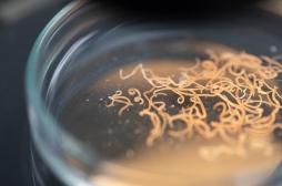 Son infection pulmonaire chronique était causée par un ver… logé dans son cerveau !