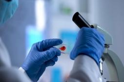 VIH : un nouveau traitement prometteur pour soigner les maladies du foie 