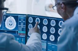 Cancer du cerveau : un facteur de risque inattendu mis en lumière