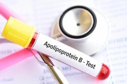 AVC, infarctus : ce test sanguin, connu mais peu utilisé, prédirait les risques