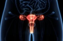 Cancer de l’ovaire : un algorithme peut identifier précocement les lésions à haut risque