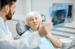Ostéoporose : une mauvaise santé dentaire augmente-t-elle vos risques ?