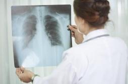 La tuberculose responsable de 1,5 million de décès dans le monde en 2018