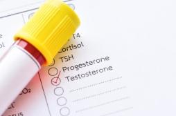 Fertilité : le taux moyen de testostérone a diminué de moitié en 50 ans