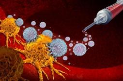 Cancer de la peau : bientôt un vaccin pour lutter contre le mélanome ? 
