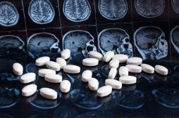 Alzheimer : une étude met en avant l’efficacité de ces médicaments déremboursés en France