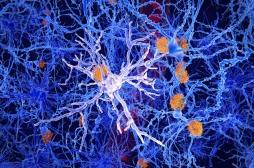 Alzheimer: pourquoi les neurones de la mémoire sont les plus vulnérables à la maladie?