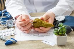 Cancer du pancréas : l’hépatite C, un facteur de risque potentiellement modifiable