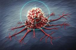 Métastases dans le cancer du sein : comment les cellules agressives se développent en se cachant 