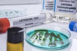 Listériose : pourquoi les cas augmentent depuis 2021 ? 