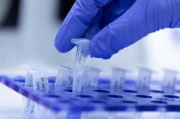 Leishmaniose viscérale : un nouveau test ultra rapide détecte directement le parasite 
