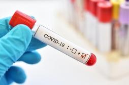 Covid-19 : une femme asymptomatique restée contagieuse pendant 70 jours