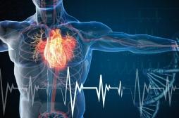 Mort subite de l'adulte : un gilet cardiaque pourrait aider à prédire le risque