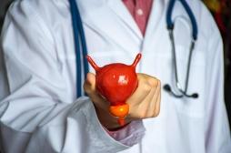 Hypertrophie de la prostate : des médicaments peuvent provoquer une insuffisance cardiaque