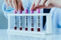 Trouble bipolaire : un test sanguin pour le diagnostiquer arrive en France
