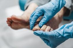 Cancer du poumon : le risque lié au radon pourrait se mesurer … dans vos ongles de pieds