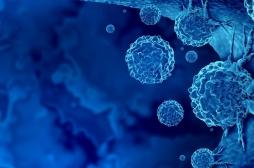 Cancer du sein : on sait comment il contourne les défenses immunitaires… et c’est une bonne nouvelle