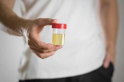Urine : des chercheurs élucident le mystère de sa couleur jaune