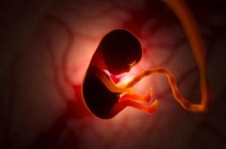 Première mondiale : un foetus opéré in utero du cerveau 