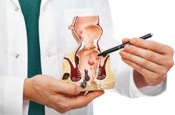 Covid-19 : le syndrome de l’anus sans repos est-il un nouveau symptôme ?