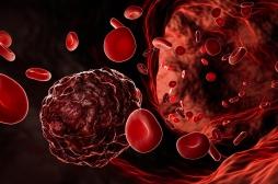 Quel est ce cancer du cœur qui a emporté Virgil Abloh, directeur artistique de Louis Vuitton ? 