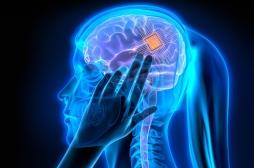Cerveau : un implant pourrait transformer les pensées en mots 