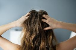 Vos cheveux peuvent indiquer à quel point vous êtes stressé