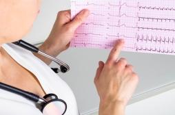 Fibrillation atriale : pourquoi la fréquence cardiaque se dérègle