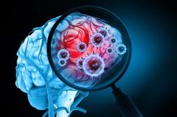 Covid-19 : le virus peut rester jusqu'à 8 mois dans le cerveau