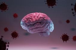 Covid-19 : le virus peut migrer vers le cerveau 