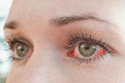 Ce signe pourrait annoncer une maladie auto-immune à venir