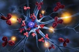 Qu'est-ce que le syndrome VEXAS, une maladie qui touche de nombreux patients ?