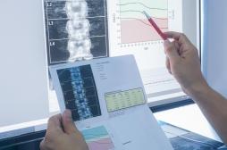 Ostéoporose : il faut demander le dépistage !