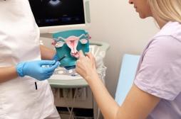 Syndrome des ovaires polykystiques : comment poser le diagnostic ?