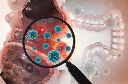 Cancer colorectal : certaines bactéries du microbiote peuvent entraver la chimiothérapie