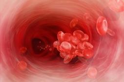 La thrombose artérielle augmente le risque de cancer 
