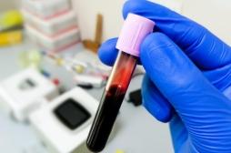 Cancers silencieux : un nouveau test sanguin pourrait les détecter de façon précoce
