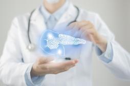 Cancer du pancréas : pourrait-on l’arrêter avant même qu'il n'apparaisse ?