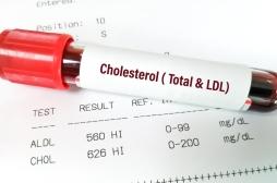 Cholestérol, triglycérides : les fluctuations des taux liés au risque d’Alzheimer 